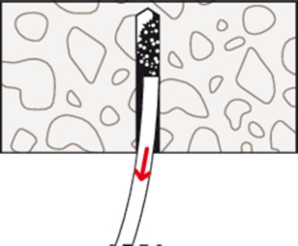 Afbeeldingen van fischer Nagelanker FNA II  6x25mm,  gegalvaniseerd, verzinkt