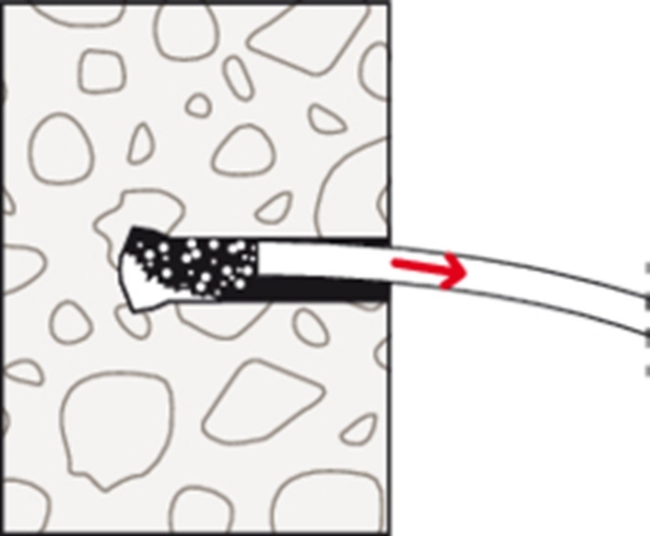 Afbeeldingen van fischer Inslaganker FZEA II 10x40 M8
