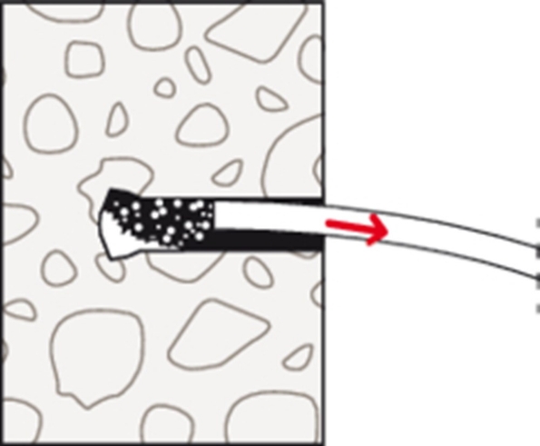Afbeeldingen van fischer Achterinsnijdend anker FZA 22x100 m 16/60